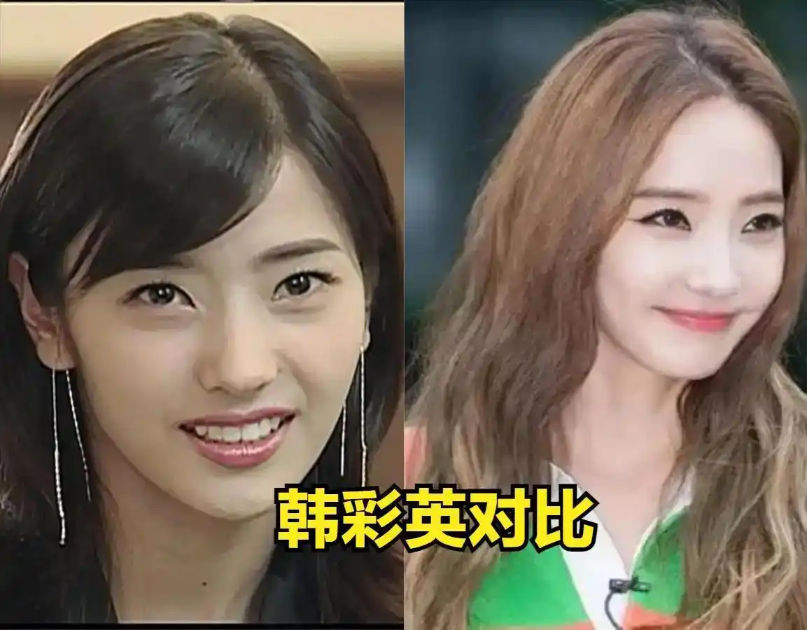 韩国整容文化_韩剧女主整容前后对比_韩剧整容女明星